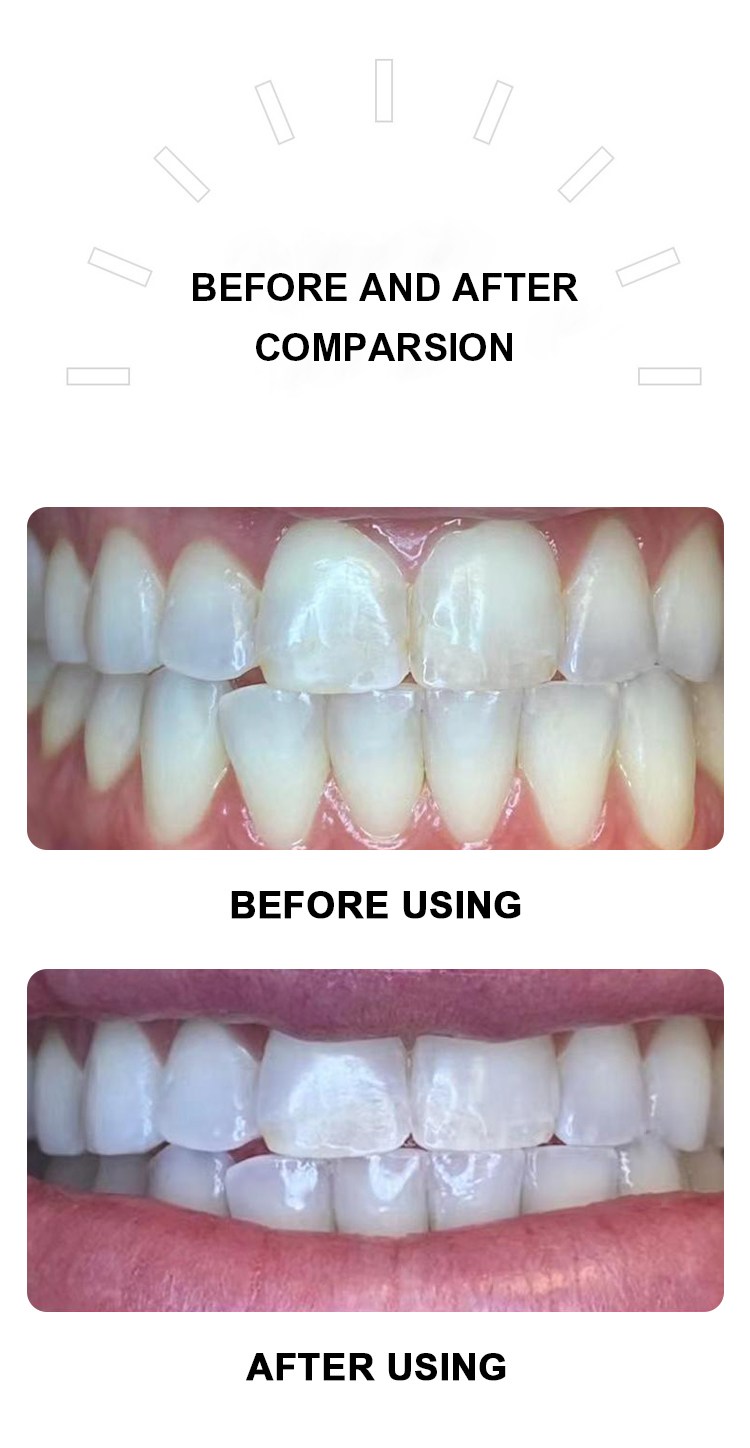 Cheap High Quality Teeth Whitening Gel For Teeth Whitening Hot Selling Teeth Whitening Gel Refill Private Logo