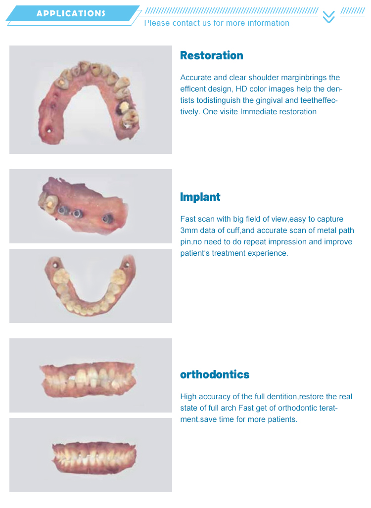 Intraoral scanner