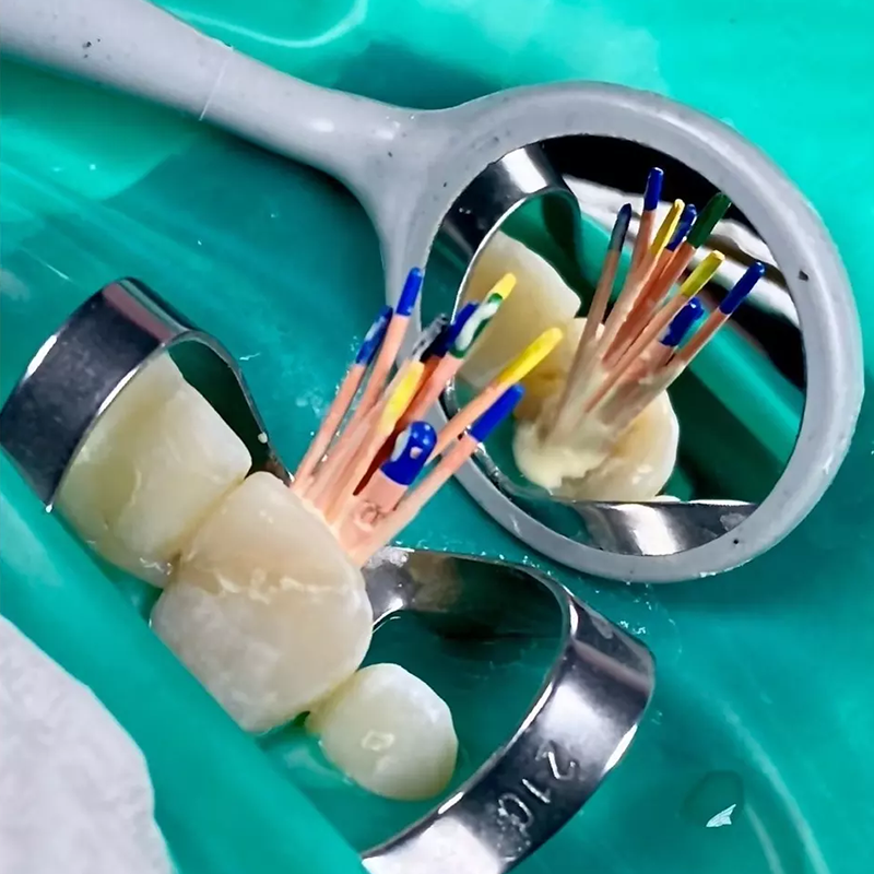root canal filling materials